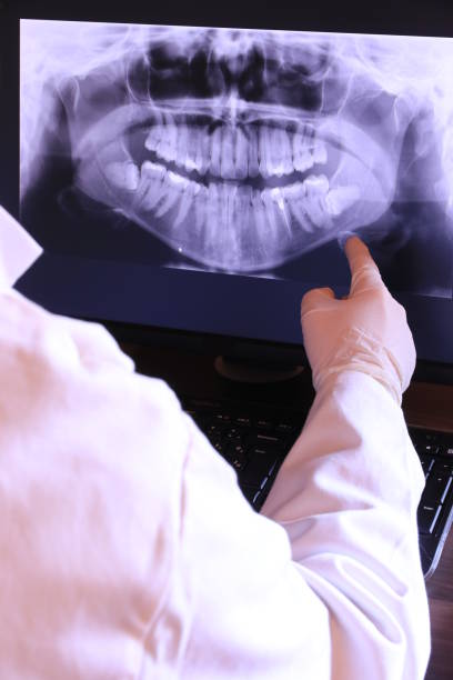 Best Emergency Root Canal Treatment in Plymouth, MI
